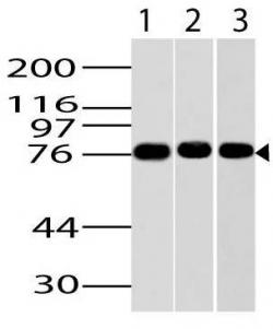Fig-1: Western blot analysis of IKKe antibody (Clone: ABM13C7) was tested at 2 µg/ml on Jurkat, NIH 3T3 and HepG2 lysates using Goat anti Mouse IgG HRP conjugated secondary antibody (11-301) with 1:5000 dilution.