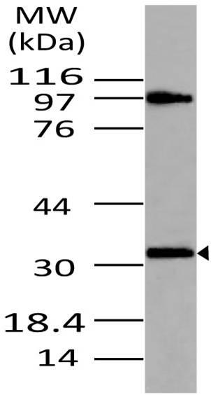 Polyclonal Antibody to MyD88
