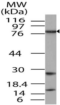 Polyclonal Antibody to TAB3