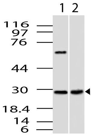 Polyclonal Antibody to CUEDC2