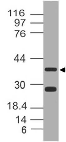 Polyclonal Antibody to Leucine rich alpha 2 glycoprotein1