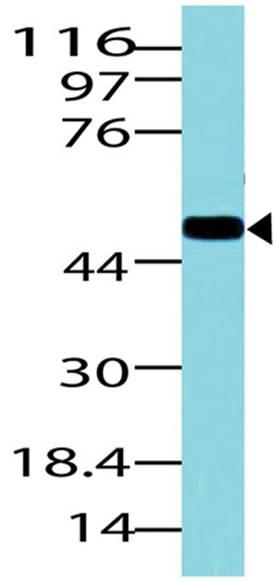 Polyclonal Antibody to Glut1