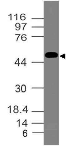 Polyclonal Antibody to  Estrogen Receptor alpha