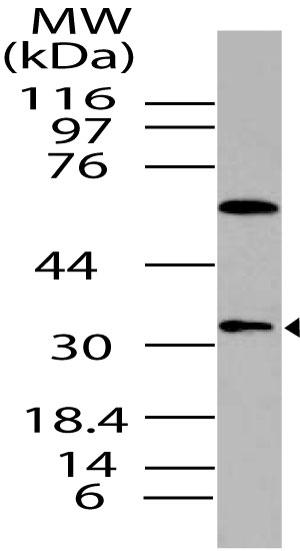 Polyclonal Antibody to DUSP13, SKRP4