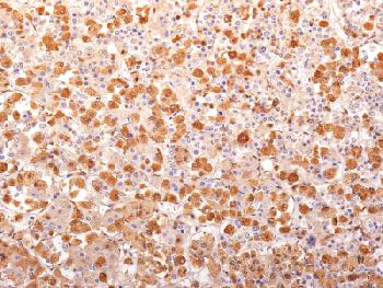 Figure 1: Formalin-fixed, paraffin-embedded human Pituitary Gland stained with ACTH Mouse Recombinant Monoclonal Antibody (r57).