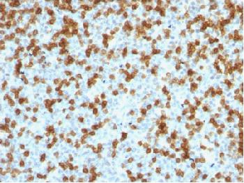 Recombinant Rabbit Monoclonal Antibody to PDCD1 / PD1 / CD279 (Programmed Cell Death 1)(Clone : PDCD1/1410R)