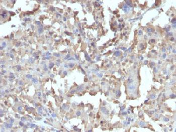 Recombinant Rabbit Monoclonal Antibody to TNF-alpha (Tumor Necrosis Factor alpha)(Clone : TNF/1500R)