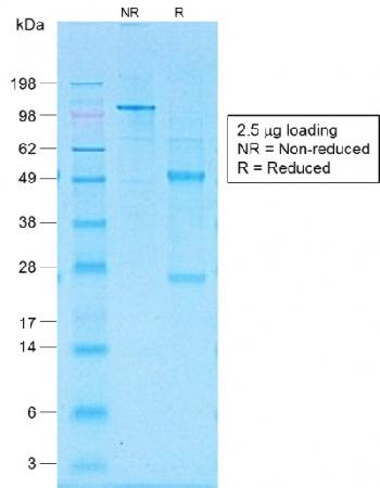Figure 2: SDS-PAGE Analysis of Purified CD30 Rabbit Recombinant Monoclonal Antibody (Ki-1/1505R).