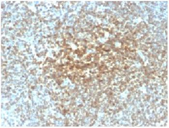 Anti-Bcl-2 (Apoptosis and Follicular Lymphoma Marker) Recombinant Mouse Monoclonal Antibody (Clone:rBCL2/782)