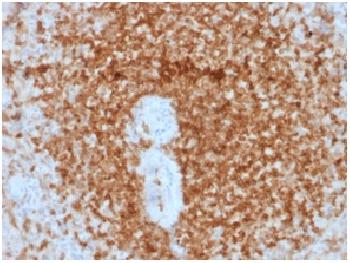 Anti-Bcl-2 (Apoptosis and Follicular Lymphoma Marker) Recombinant Mouse Monoclonal Antibody (Clone:rBCL2/796)