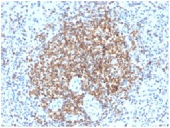 Anti-Bcl-2 (Apoptosis& Follicular Lymphoma Marker) Recombinant Rabbit Monoclonal Antibody (Clone:BCL2/2210R)