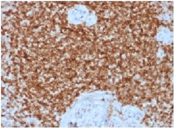 Anti-Bcl-2 (Apoptosis& Follicular Lymphoma Marker) Recombinant Rabbit Monoclonal Antibody (Clone:BCL2/1878R)