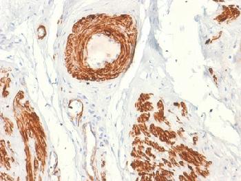 Anti-Caldesmon, HMW (h-Caldesmon) (Smooth Muscle Marker) Recombinant Mouse Monoclonal Antibody (Clone:rCALD1/820)