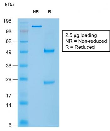 Figure 2: SDS-PAGE Analysis of Purified Caldesmon Mouse Recombinant Monoclonal Antibody (rCALD1/820).