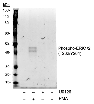 Phospho-p44/42 MAPK (Erk1/2) (Thr202/Tyr204) (Clone: A11) rabbit mAb