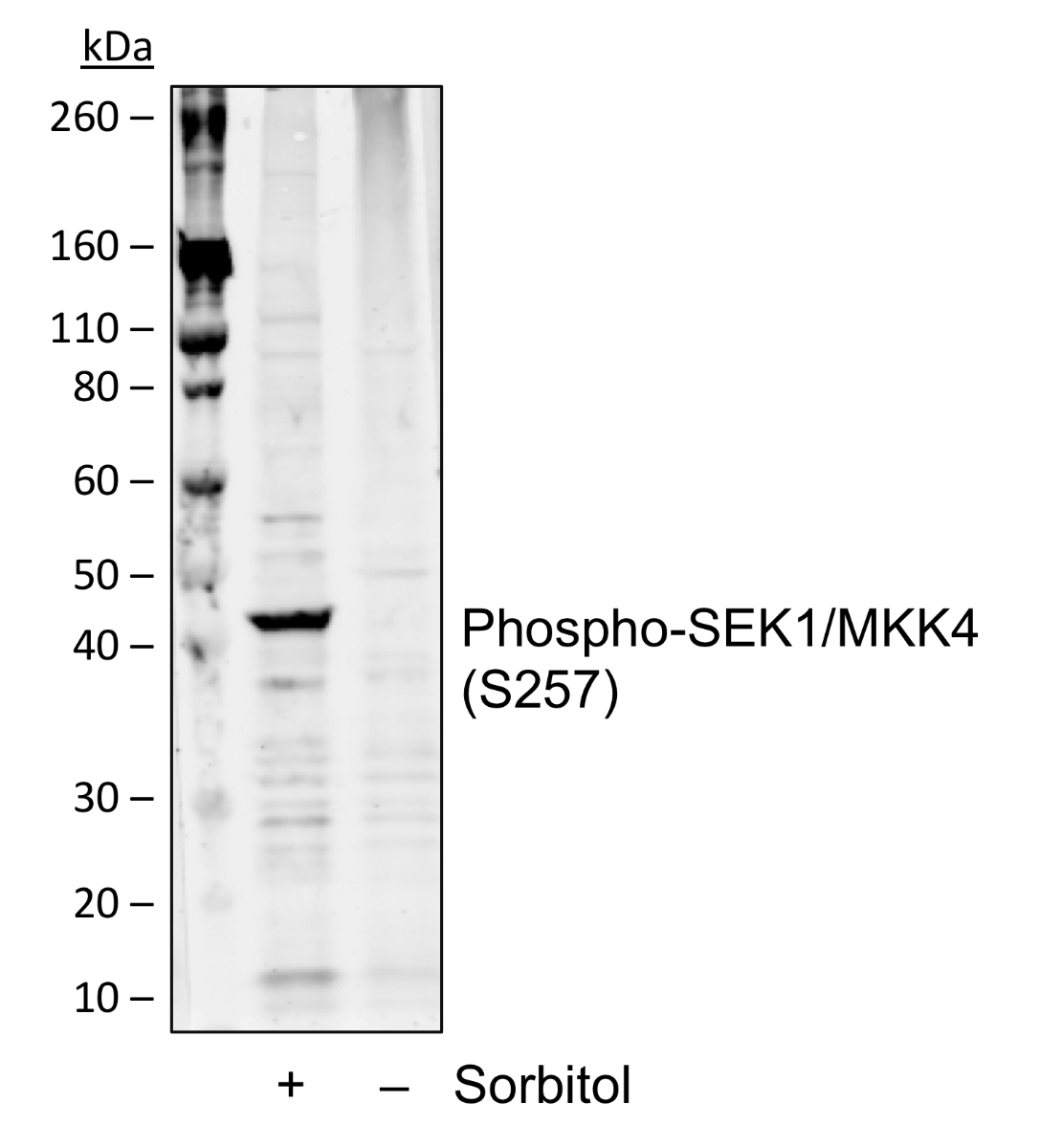 Phospho-SEK1/MKK4 (Ser257) (Clone: C5) rabbit mAb