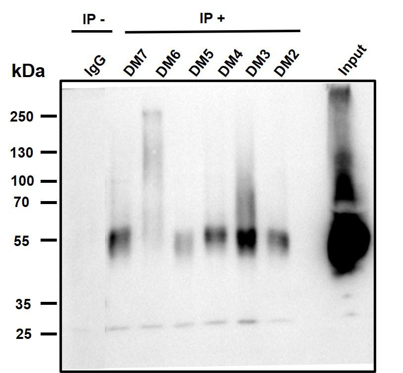 Figure 6. Immunoprecipitation analysis. Cellular overexpression lysates (made from HEK293F cells transfected with FLAG tagged human BCMA full length gene) were pre-incubated with 6 different rabbit clones and negative control IgG. The immunocomplexes were further pulled down by protein A beads, fractionated, and blotted with mouse anti-FLAG monoclonal antibody.