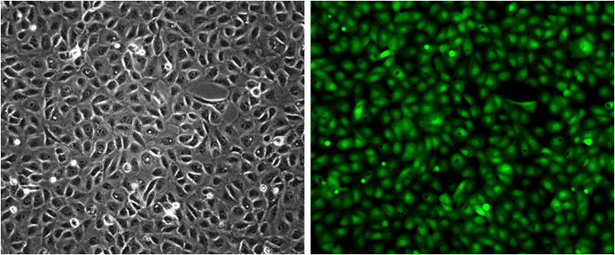Fig-1:  Analysis of the GFP/VERO stable cell line through fluorescence microscopy. Bright-field image (Left); Fluorescence image (Right).
