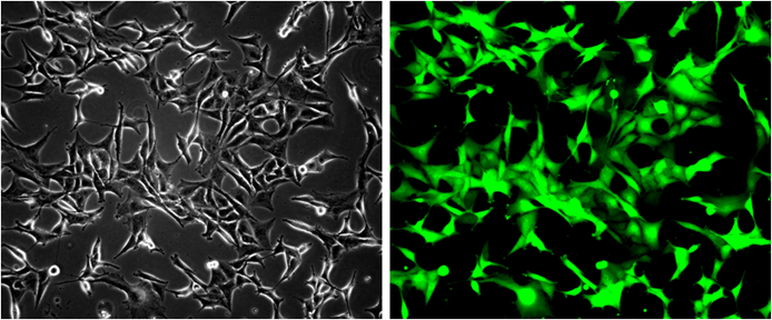 Fig-1:  Analysis of the GFP/U87MG stable cell line through fluorescence microscopy. Bright-field image (Left); Fluorescence image (Right).