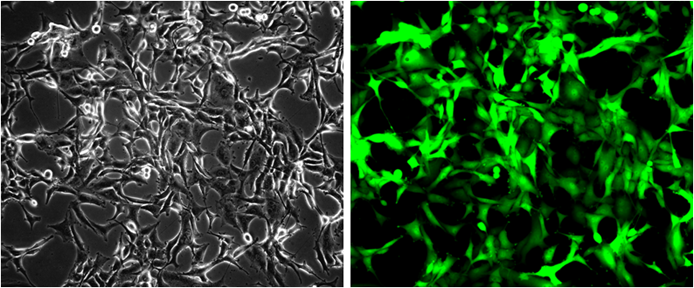 Fig-1:  Analysis of the GFP/HeLa stable cell line through fluorescence microscopy. Bright-field image (Left); Fluorescence image (Right).