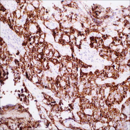 Anti-FSH Rabbit Monoclonal Primary Antibody (Clone: EP257) Anti-FSH Rabbit Monoclonal Primary Antibody (Clone: EP257)