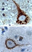 Polyclonal antibody to Caspase-9