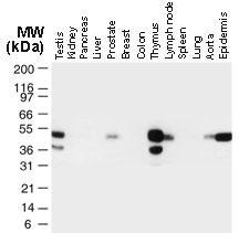 Polyclonal antibody to TRAF-1