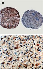 Polyclonal antibody to Caspase-8