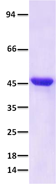 SARS-CoV-2/COVID-19 Nucleocapsid Protein His Tag SARS-CoV-2/COVID-19 Nucleocapsid Protein His Tag