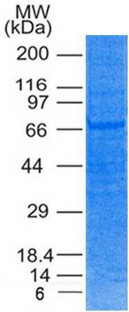 Recombinant Human TRIM29 His Tag protein