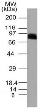 Figure-2: Western blot analysis of SARS-CoV-2 Spike S1 S13l / W152C / L452R mutant protein. Anti-Spike S1 antibody was used in western Blot analysis.