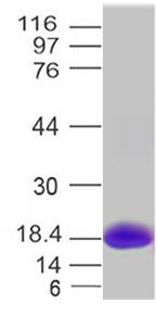 Recombinant MPXV L1R Protein, N-Term His (Ecoli)