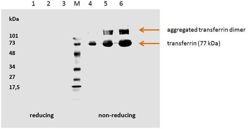 Figure-1: Human transferrin detected by the mouse monoclonal antibody HTF-14. 1. hTransferrin; 5 µg/well (red. con.) 2. hTransferrin; 3 µg/well (red. con.) 3. hTransferrin; 1 µg/well (red. con.) M. Low Range marker (Bio-Rad) 4. hTransferrin; 1 µg/well (non-red. con.) 5. hTransferrin; 3 µg/well (non-red. con.) 6. hTransferrin; 5 µg/well (non-red. con.)