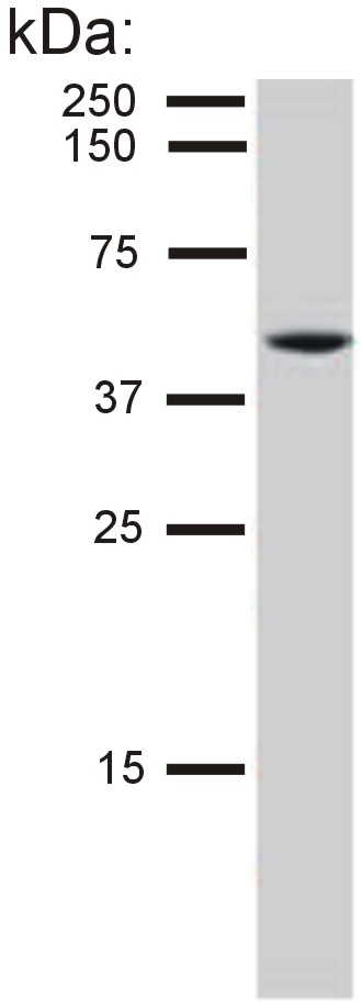 Anti-Cytokeratin 8 Monoclonal Antibody (Clone:C-51)