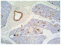 Figure-1: Immunohistochemistry staining of pancreas (paraffin-embedded sections) with anti-Cytokeratin 7+17 (C-46).
