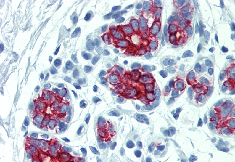 Figure-2: Immunohistochemistry staining of human breast (paraffin-embedded sections) with anti-cytokeratin 7+17 (C-46).