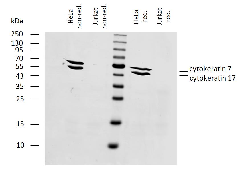 Figure-3: Western blotting analysis of human cytokeratin 7+17 using mouse monoclonal antibody C-46 on lysates of HeLa cell line and Jurkat cell line (cytokeratin non-expressing cell line; negative control) under non-reducing and reducing conditions. Nitrocellulose membrane was probed with 2 µg/ml of mouse anti-cytokeratin 7+17 monoclonal antibody C-46 followed by IRDye800-conjugated anti-mouse IgG1 secondary antibody. A specific band was detected for cytokeratin 17 at approximately 46 kDa and for cytokeratin 7 at approximately 54 kDa.