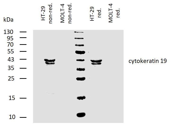 Figure-3: Western blotting analysis of human cytokeratin 19 using mouse monoclonal antibody BA-17 on lysates of HT-29 cell line and MOLT-4 cell line (cytokeratin non-expressing cell line; negative control) under non-reducing and reducing conditions. Nitrocellulose membrane was probed with 2 µg/ml of mouse anti-cytokeratin 19 monoclonal antibody followed by IRDye800-conjugated anti-mouse secondary antibody. A specific band was detected for cytokeratin 19 at approximately 41 kDa.