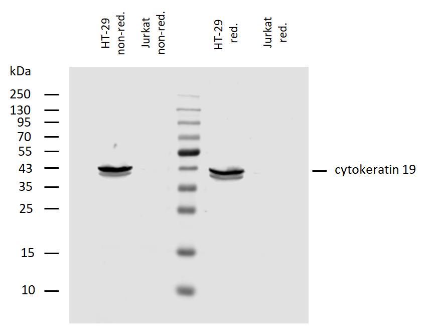 Anti-Cytokeratin 19 Monoclonal Antibody (Clone:A53-B/A2)