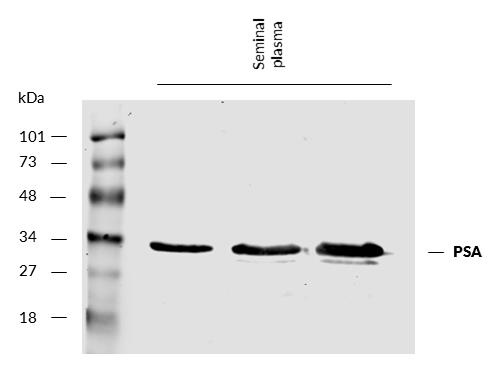 Anti-Prostate-specific antigen (PSA) Monoclonal Antibody (Clone:A67-B/E3)
