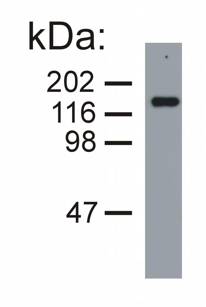 Figure 1: Western blotting analysis of neurofilament medium protein in porcine brain lysate (reducing conditions) by mouse monoclonal NF-09.