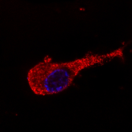 Figure 2: Immunofluorescence staining of neurofilament medium protein in murine Neuro2A cells by antibody NF-09 conjugated with Dyomics 547 (red). DNA stained by Hoechst (blue).