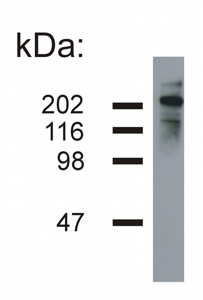 Anti-Neurofilament heavy protein Monoclonal Antibody (Clone:NF-05)