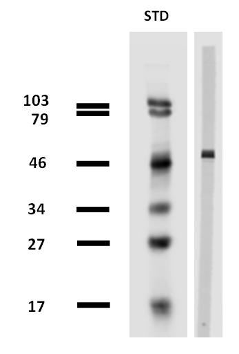 Anti-beta-tubulin / TUBB Monoclonal Antibody (Clone:TU-13)