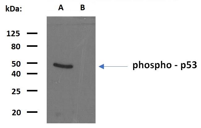 Anti-p53 (Phospho-Ser392) Monoclonal Antibody (Clone:FP3.2 [FPS392])