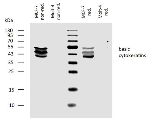 Anti-Basic Cytokeratins Monoclonal Antibody (Clone:AE3)