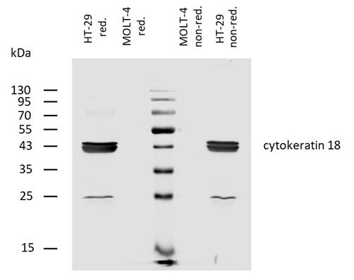 Biotin Conjugated, Anti-Cytokeratin 18 Monoclonal Antibody (Clone:C-04)