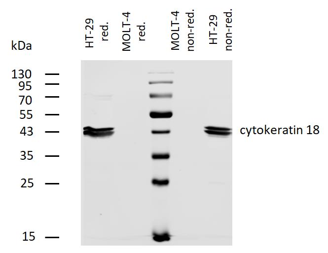 Figure-2: Western blotting analysis of human cytokeratin 18 using mouse monoclonal antibody DC-10 on lysates of HT-29 cell line and MOLT-4 cell line (cytokeratin non-expressing cell line; negative control) under non-reducing and reducing conditions. Nitrocellulose membrane was probed with 2 µg/ml of biotinylated mouse anti-cytokeratin 18 monoclonal antibody followed by IRDye800-conjugated streptavidin. Cytokeratin 18 was detected at approximately 46 kDa.