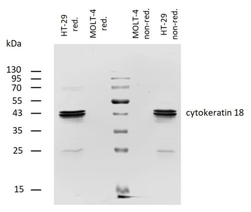 Biotin Conjugated, Anti-Cytokeratin 18 Monoclonal Antibody (Clone:DA-7)