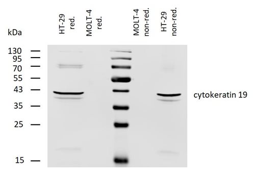 Anti-Cytokeratin 19 Monoclonal Antibody (Clone:BA-17)-Biotin Conjugated